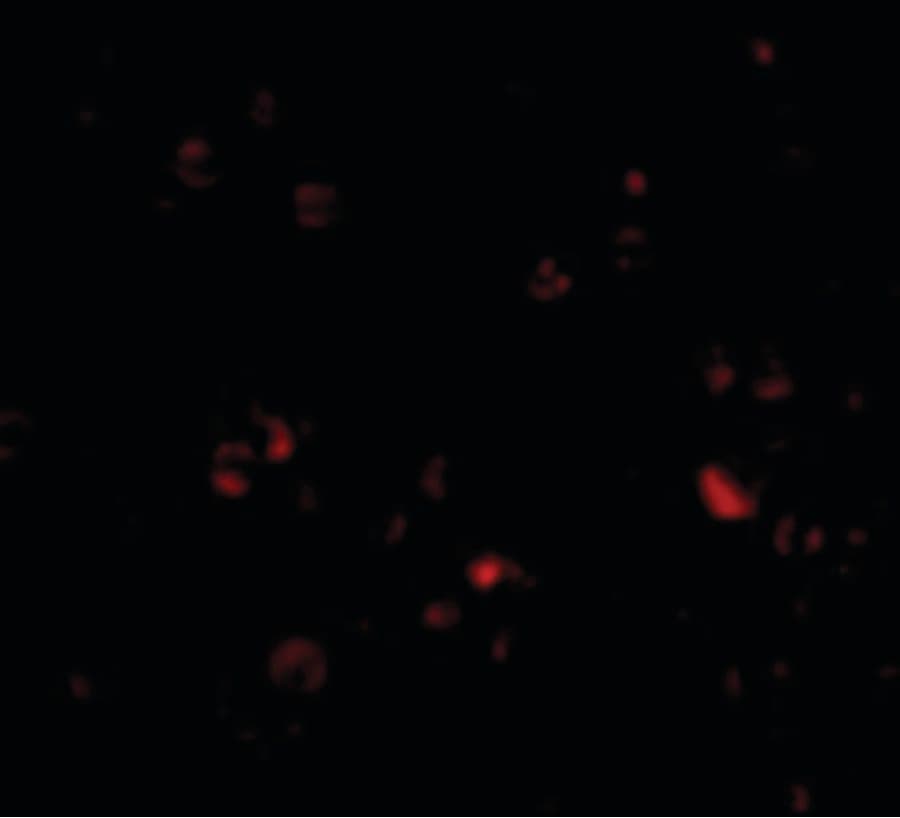 IHC-plus™ DDX3 / DDX3X Antibody