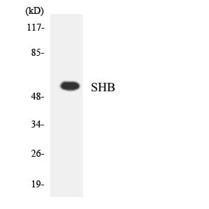 SHB Antibody (aa398-447)