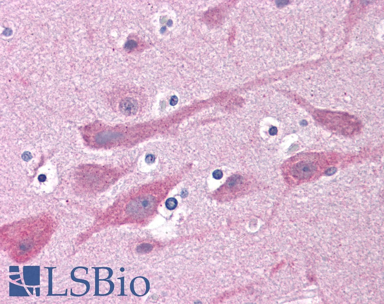 IHC-plus™ GABRB1 Antibody