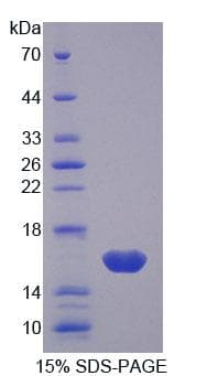 Mouse LGALS1 / Galectin 1 Protein (Recombinant His)