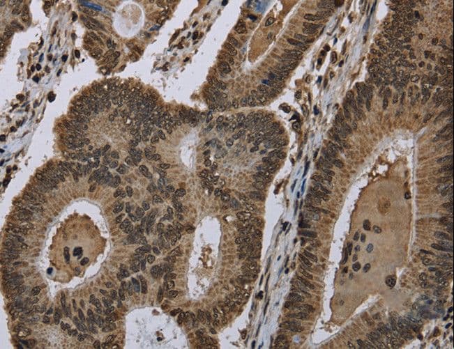 Polyclonal Rabbit anti-Human HIST1H2AH Antibody (IHC, WB)