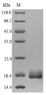 Mycobacterium bovis HSP 16.3 Protein (Recombinant 6His, N-terminus)