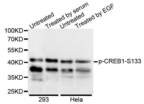 CREB1 / CREB Antibody (phospho-Ser133)