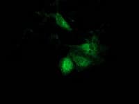 ACAT2 Antibody (clone OTI7B1)