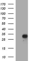 Placental Lactogen Antibody (clone OTI2A2)