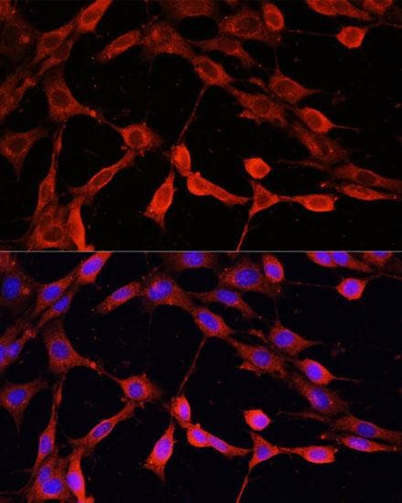 DNASE1 / DNase I Antibody