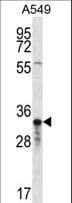 OR4F5 Antibody (aa61-89)