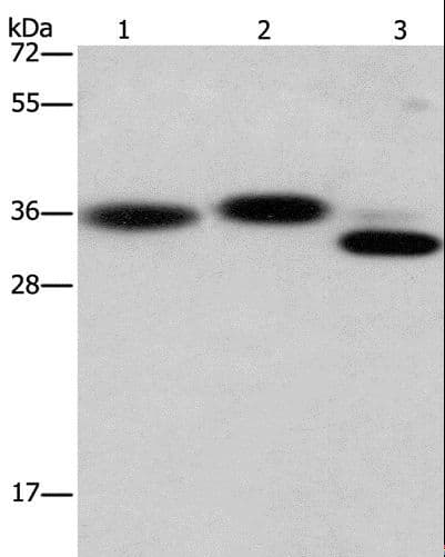 CAPZA2 / CAPZ Alpha 2 Antibody