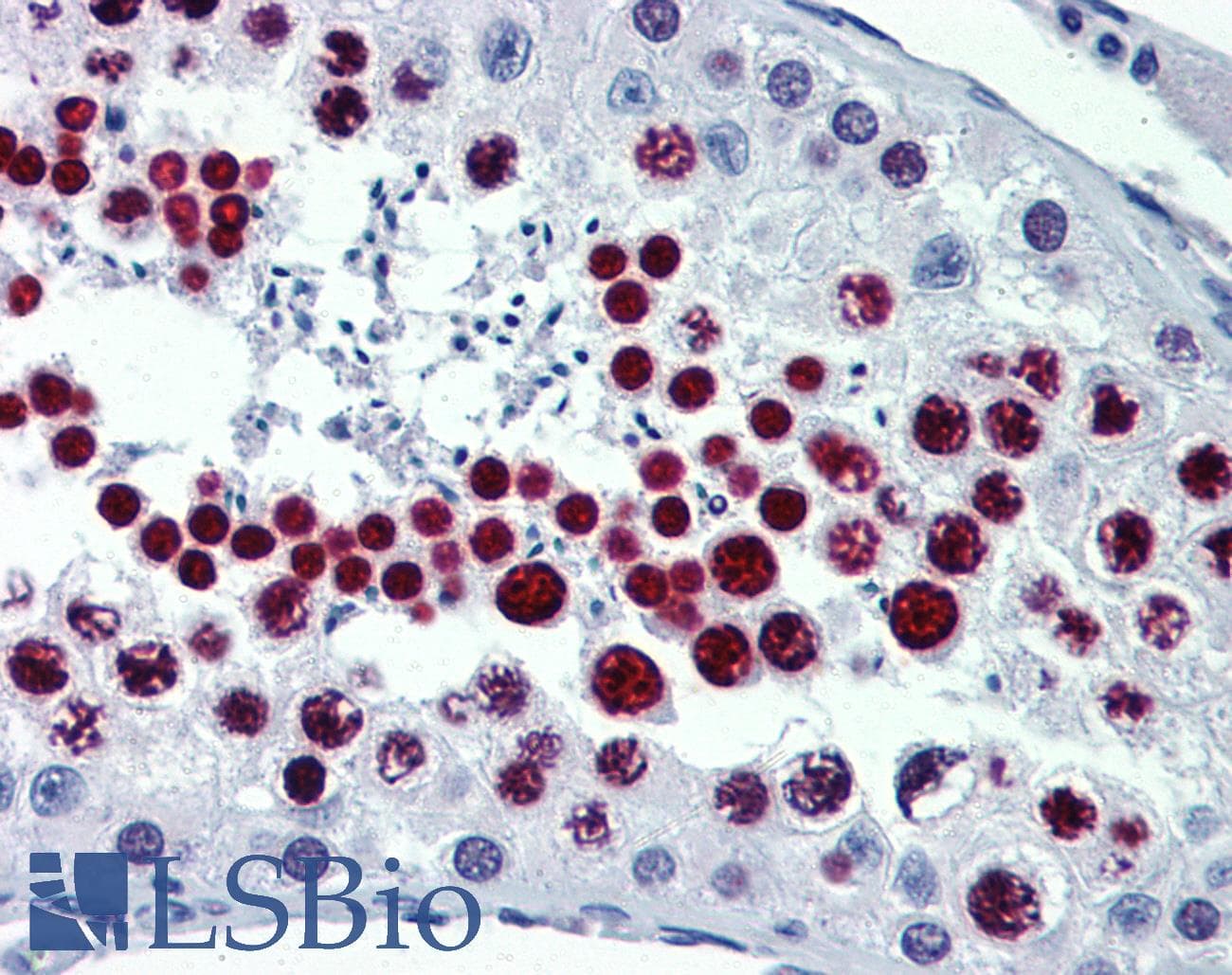 IHC-plus™ METTL7B Antibody