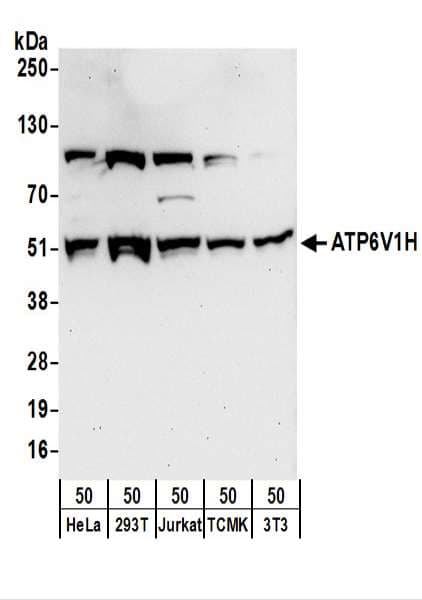 Polyclonal Rabbit anti-Human ATP6V1H Antibody (aa400-450, WB)