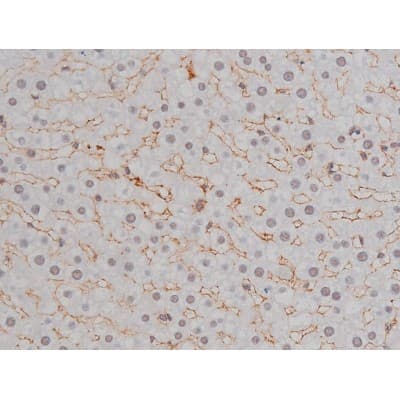 NPM1 / NPM / Nucleophosmin Antibody (phospho-Thr199)
