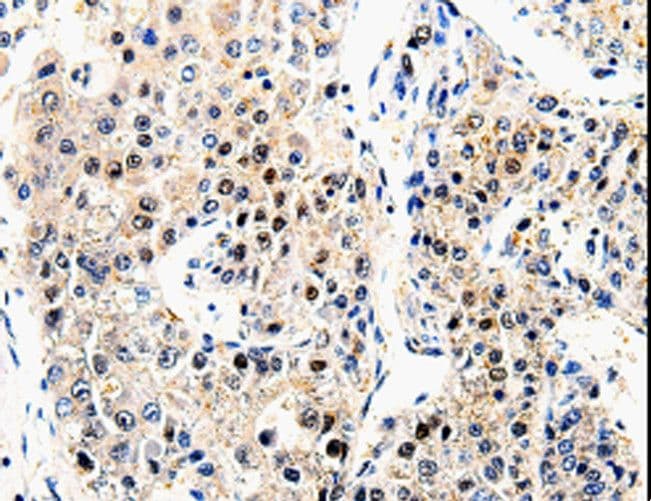 Beta Amyloid Antibody