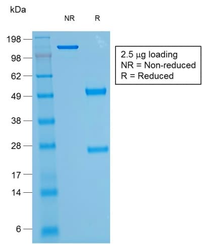 Recombinant Monoclonal Mouse anti-Human SPN / CD43 Antibody (clone rSPN/1094, IHC, IF, WB)