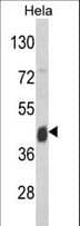 IHC-plus™ ASS1 / ASS Antibody (aa192-221)