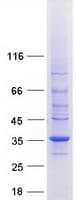Human STOM / Stomatin Protein (Recombinant Myc-DDK (Flag))