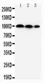 Polyclonal Rabbit anti-Human HIF2A / EPAS1 Antibody (aa282-301, WB)