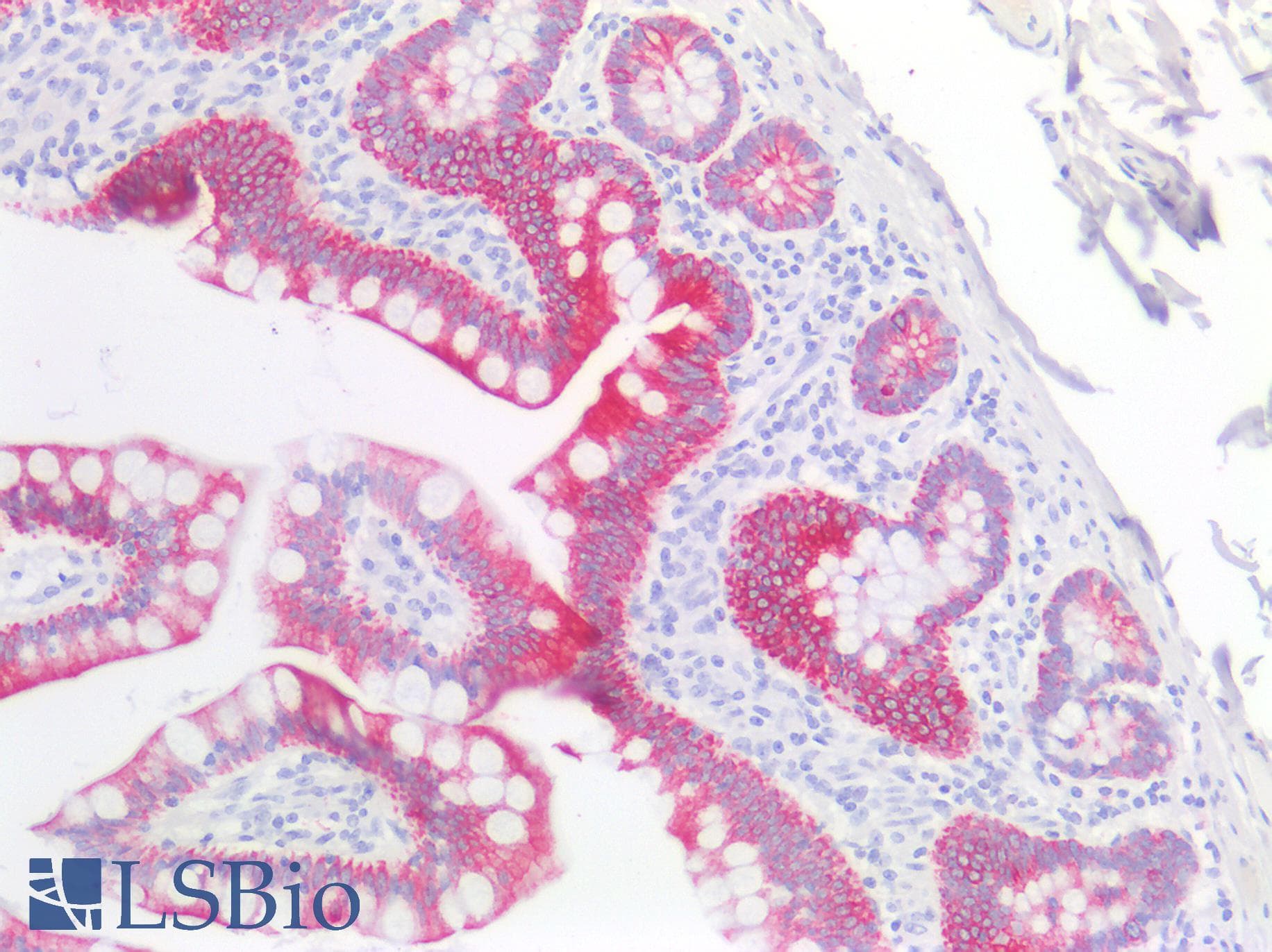 PathPlus™ Cytokeratin 4+5+6+8+10+13+18 Antibody (clone C11)