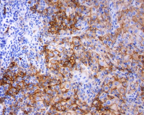 CD274 / B7-H1 / PD-L1 Antibody (C-Terminus, clone OR-5H8)