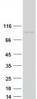 Human MAGED2 Protein (Recombinant Myc-DDK (Flag))