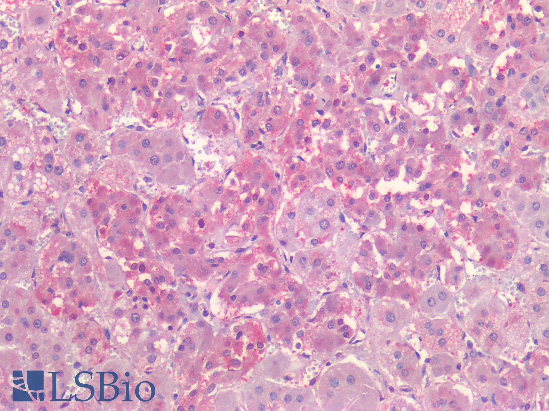 PathPlus™ NR5A1 / SF1 Antibody (Internal)