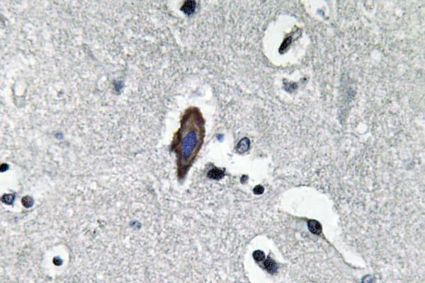 MIP / AQP0 / Aquaporin 0 Antibody (aa95-144)