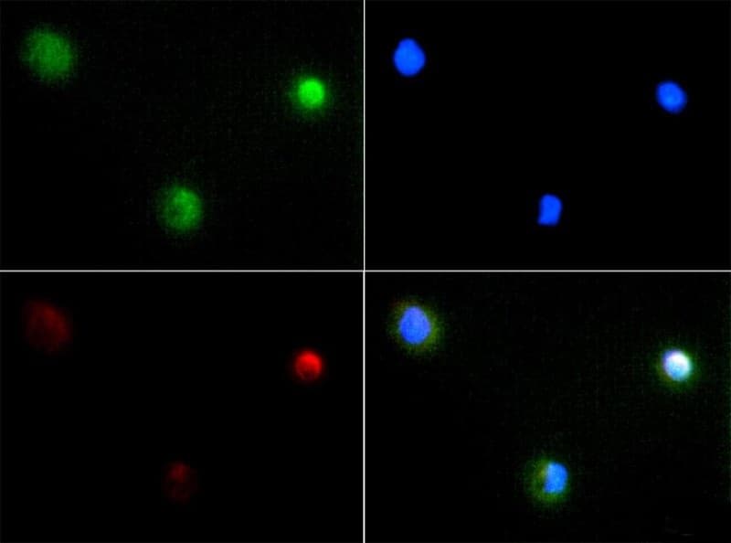 PIEZO2 / FAM38B Antibody