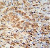PRDX1 / Peroxiredoxin 1 Antibody (aa88-116)