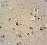 MPZ / P0 Antibody (aa186-215)