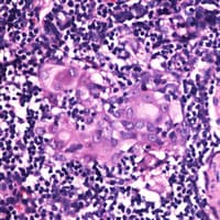 RGS1 Antibody (Internal)