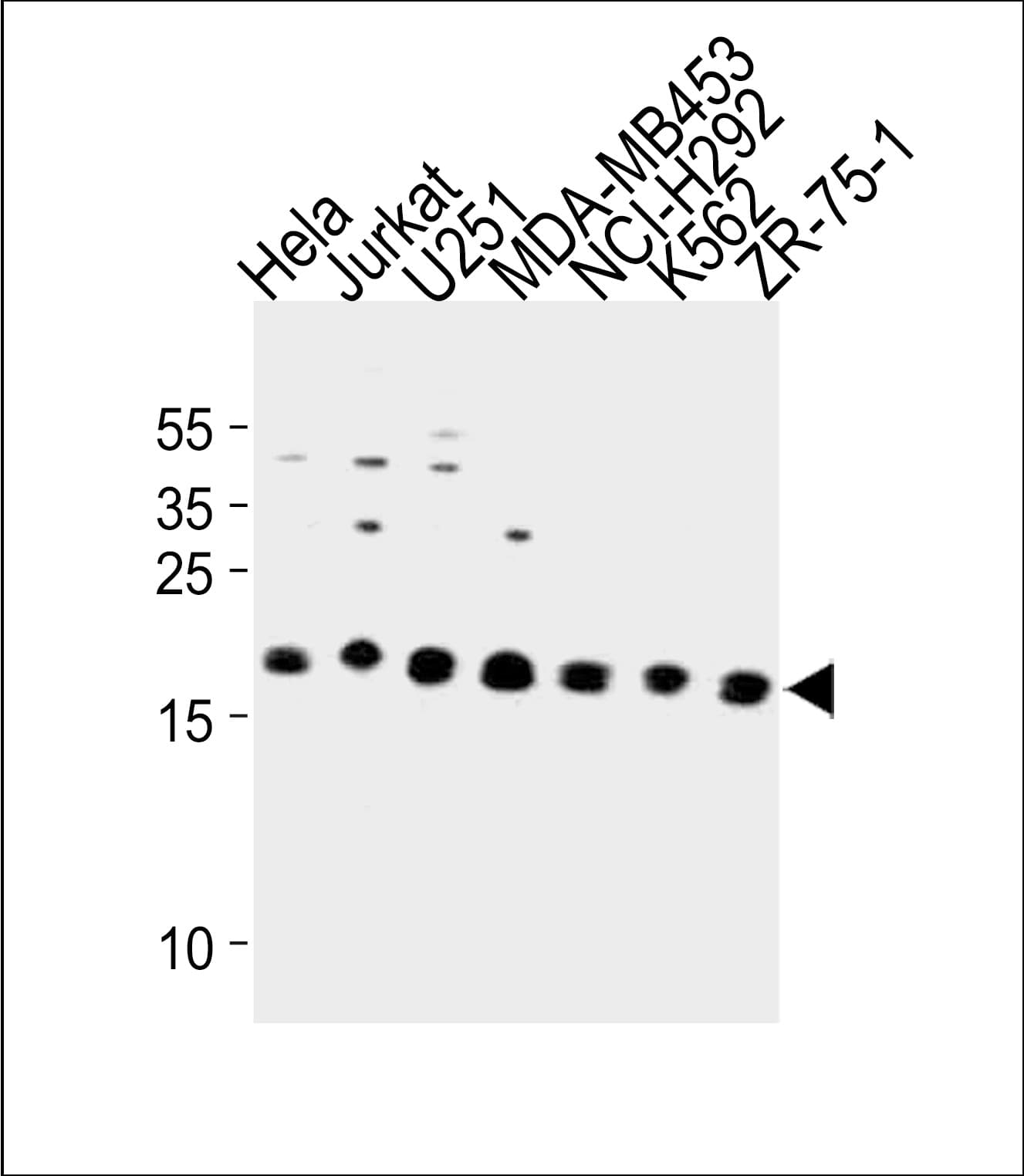 ICT1 / DS1 Antibody (aa153-179)