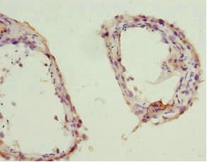 Polyclonal Rabbit anti-Human ZWINT Antibody (IHC, WB)