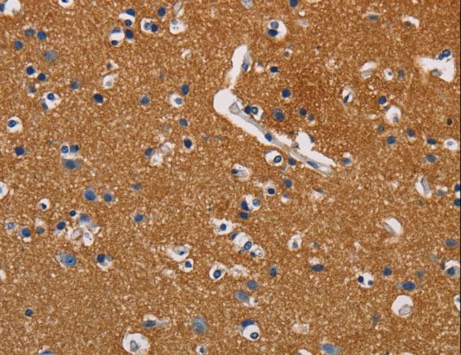 Polyclonal Rabbit anti-Human GPM6A / Glycoprotein M6A Antibody (IHC, WB)