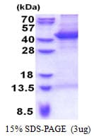Human MOAP1 / MAP1 Protein (Recombinant His)