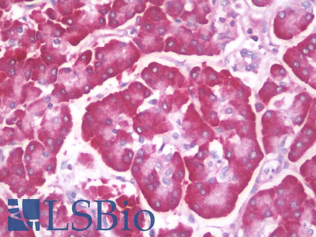 IHC-plus™ Polyclonal Rabbit anti-Human UNG / Uracil DNA Glycosylase Antibody (IHC, IF, WB)
