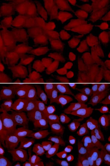IHC-plus™ OGT / O-GLCNAC Antibody