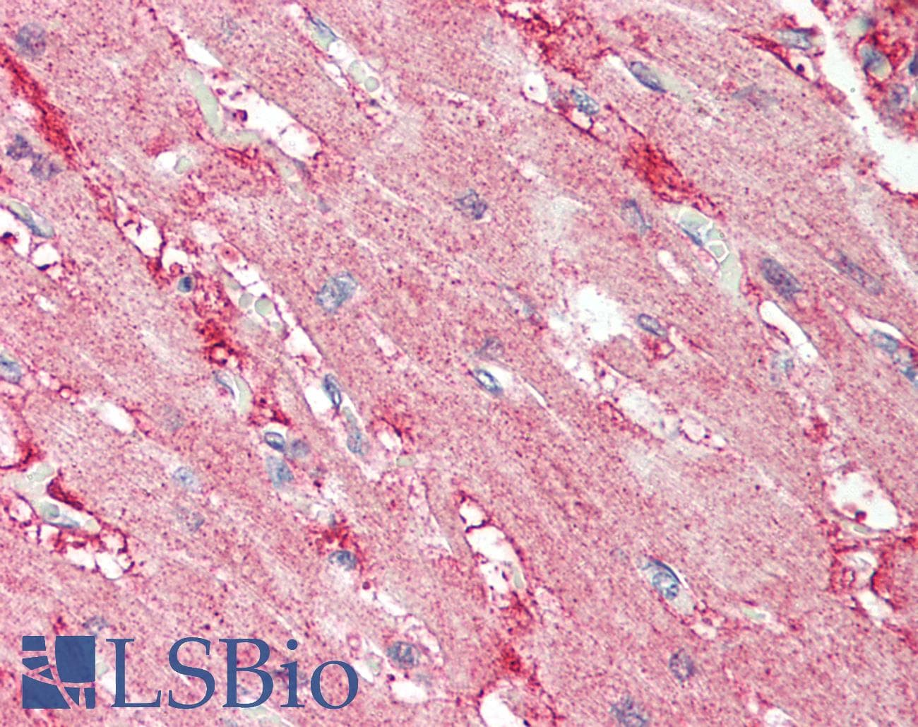 PathPlus™ Polyclonal Rabbit anti-Human ALK2 / ACVR1 Antibody (aa138-170, IHC, WB)