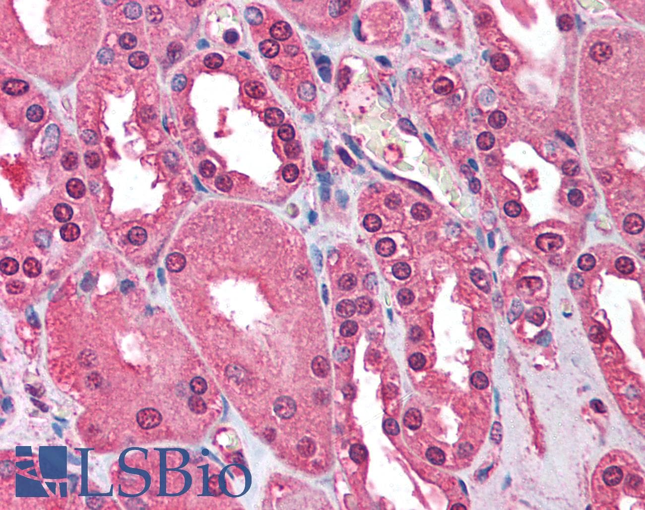 IHC-plus™ ATM Antibody