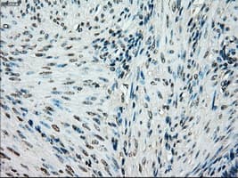 BRAF / B-Raf Antibody (clone OTI4A5)