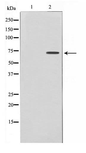 DYRK1B Antibody