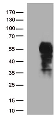 PDCD1 / CD279 / PD-1 Antibody (clone OTI14C5)