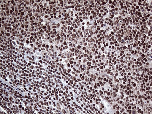 PPP4C Antibody (clone OTI2E4)