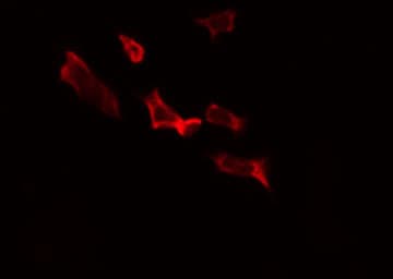 Polyclonal Rabbit anti-Human ALDH1B1 Antibody (IF, WB)