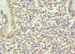 Polyclonal Rabbit anti-Human BMP15 Antibody (aa143-392, IHC)