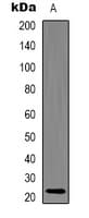 HSPB8 / H11 / HSP22 Antibody