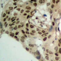 Polyclonal Rabbit anti-Human PHAP1 / ANP32A Antibody (IHC, WB)