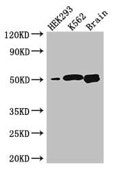 HSBLMHC1 / BTNL2 Antibody