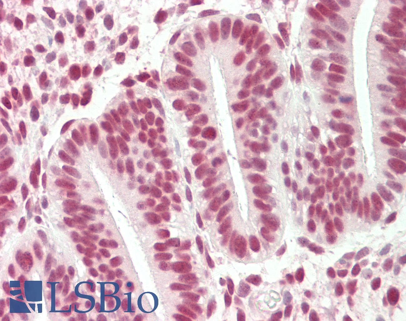 IHC-plus™ Polyclonal Goat anti-Human STAG2 Antibody (aa1100-1150, IHC, WB)