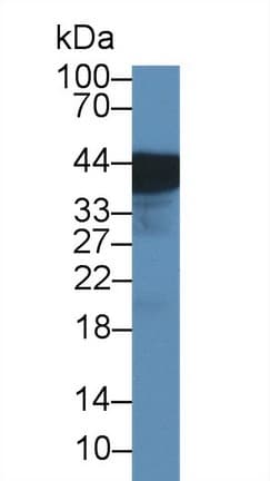 UPK3A / UPK3 / Uroplakin III Antibody (aa15-212, APC)