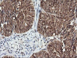 FAK / Focal Adhesion Kinase Antibody (clone OTI4G7)