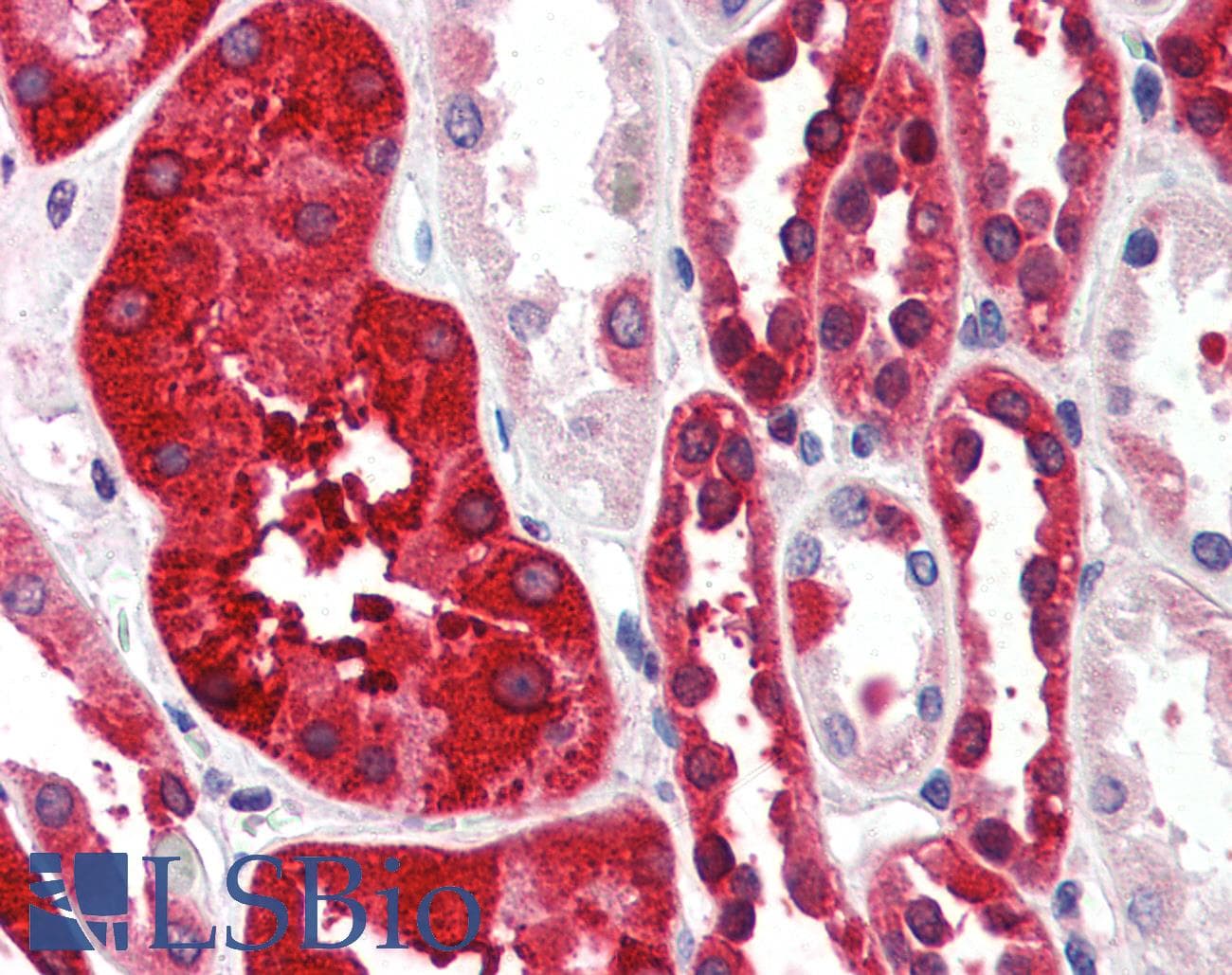 IHC-plus™ Polyclonal Goat anti-Human FTH1 / Ferritin Heavy Chain Antibody (aa221-232, IHC, WB)